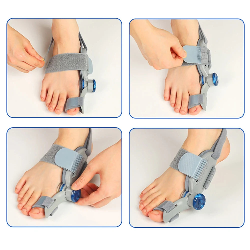 Nighttime Bunion Alignment Splint