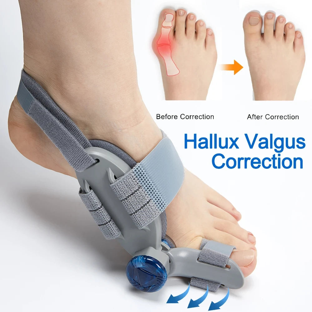 Nighttime Bunion Alignment Splint